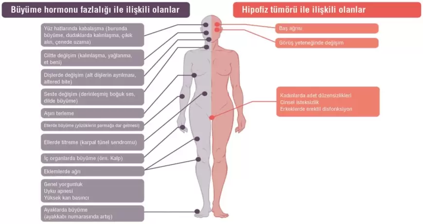 Akromegali hastalığı nedir?